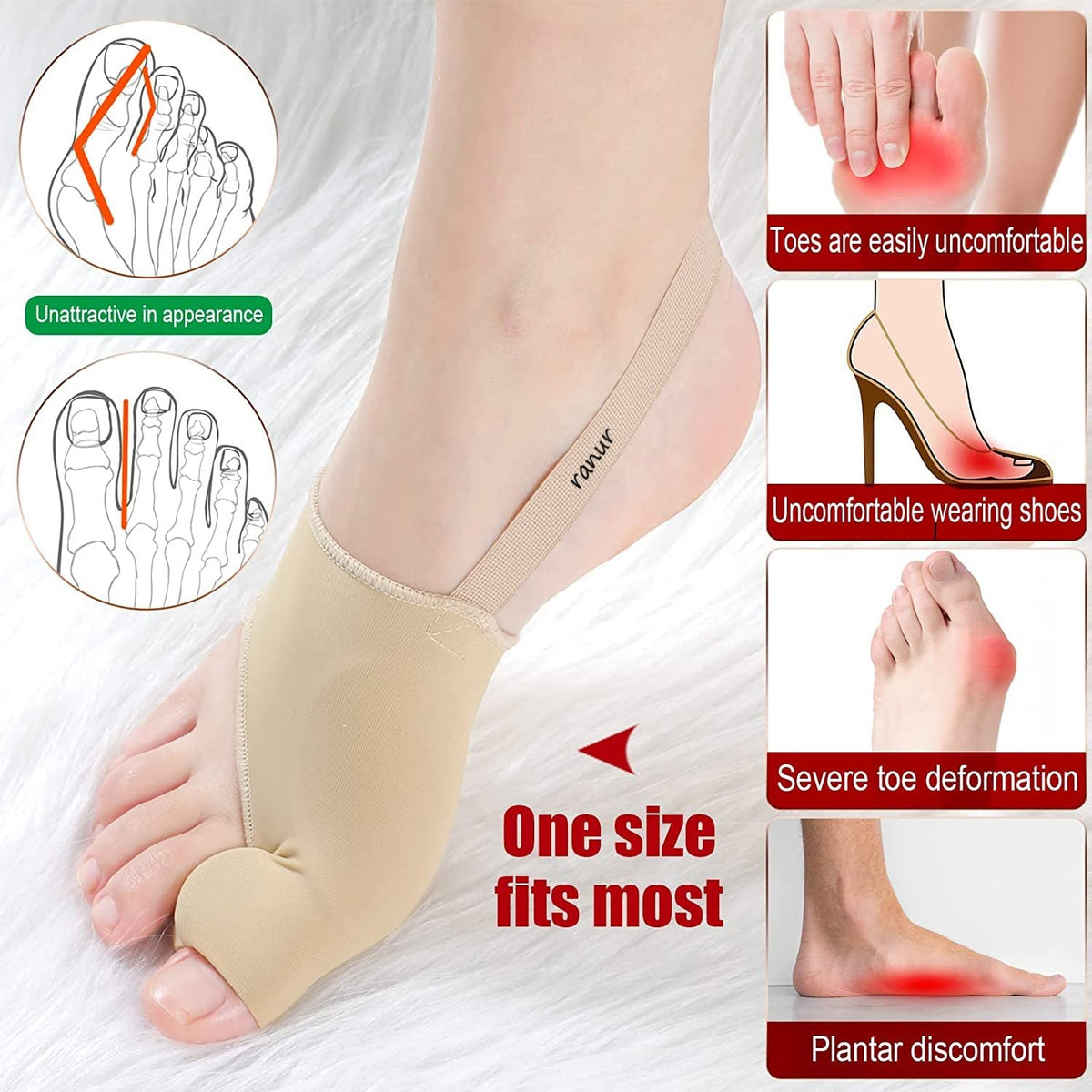 Smart Care Bunion Support Foot Correction Socks – Toe Separator & Bunion Relief